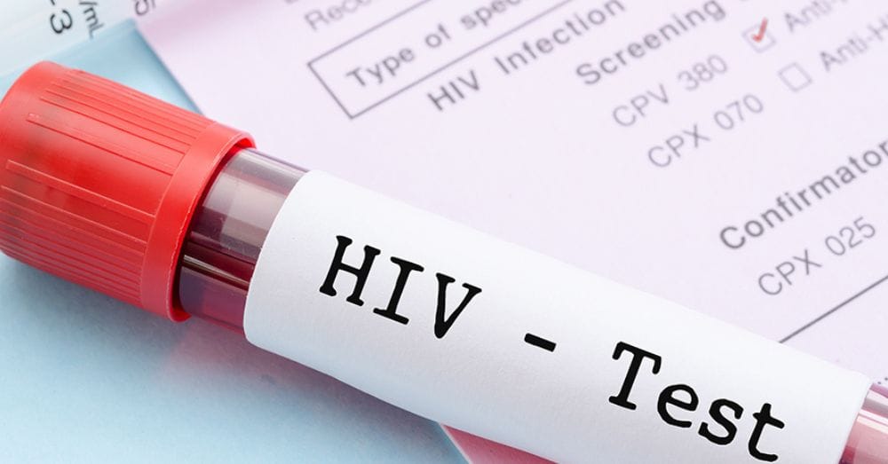 HIV - Martins Advogados